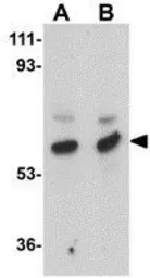 Anti-MATN3 antibody used in Western Blot (WB). GTX85286