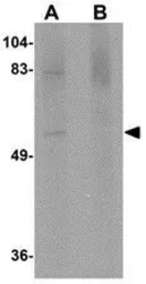 Anti-MATN4 antibody used in Western Blot (WB). GTX85294