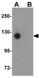 Anti-PCDH18 antibody used in Western Blot (WB). GTX85299