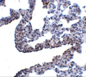 Anti-PCDH12 antibody used in IHC (Paraffin sections) (IHC-P). GTX85342