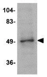 Anti-ZBTB2 antibody used in Western Blot (WB). GTX85352