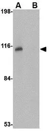 Anti-JPH3 antibody used in Western Blot (WB). GTX85363