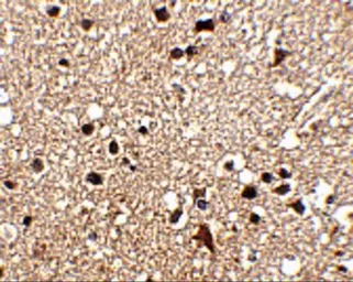 Anti-JPH3 antibody used in IHC (Paraffin sections) (IHC-P). GTX85366