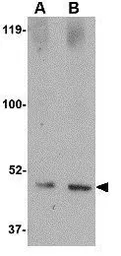 Anti-Spred1 antibody used in Western Blot (WB). GTX85376