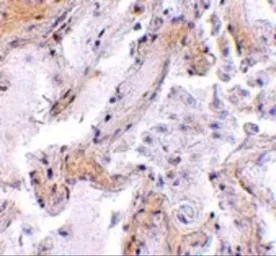 Anti-Calpain 6 antibody used in IHC (Paraffin sections) (IHC-P). GTX85383