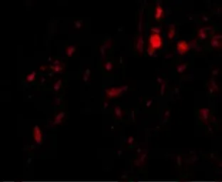 Anti-Calpain 6 antibody used in IHC (Paraffin sections) (IHC-P). GTX85383