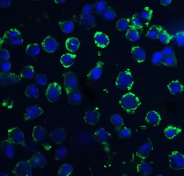 Anti-DNAL1 antibody used in Immunocytochemistry/ Immunofluorescence (ICC/IF). GTX85387