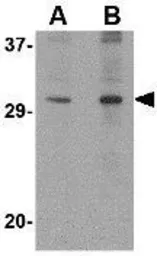 Anti-DNAL1 antibody used in Western Blot (WB). GTX85387