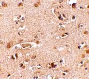 Anti-Nanos2 antibody used in IHC (Paraffin sections) (IHC-P). GTX85391