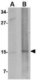 Anti-Nanos2 antibody used in Western Blot (WB). GTX85391