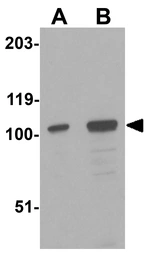 Anti-Dlgap2 antibody used in Western Blot (WB). GTX85395