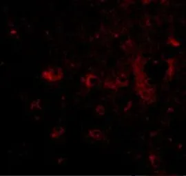 Anti-CAPS2 antibody used in IHC (Paraffin sections) (IHC-P). GTX85405