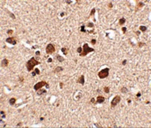 Anti-SLITRK6 antibody used in IHC (Paraffin sections) (IHC-P). GTX85412