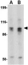 Anti-SLITRK6 antibody used in Western Blot (WB). GTX85412