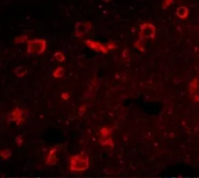 Anti-SLITRK6 antibody used in IHC (Paraffin sections) (IHC-P). GTX85412