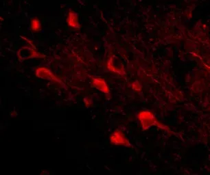 Anti-Slitrk5 antibody used in IHC (Paraffin sections) (IHC-P). GTX85413