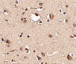 Anti-Slitrk3 antibody used in IHC (Paraffin sections) (IHC-P). GTX85416