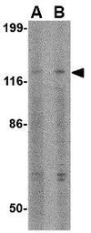 Anti-Slitrk3 antibody used in Western Blot (WB). GTX85416