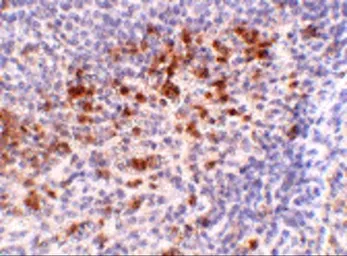 Anti-Cathelicidin antibody used in IHC (Paraffin sections) (IHC-P). GTX85418