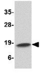 Anti-Cathelicidin antibody used in Western Blot (WB). GTX85418