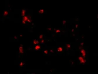 Anti-Cathelicidin antibody used in IHC (Paraffin sections) (IHC-P). GTX85418