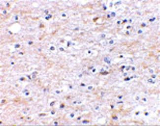 Anti-FNBP1L antibody used in IHC (Paraffin sections) (IHC-P). GTX85424