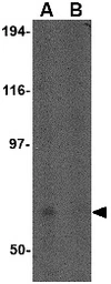 Anti-FNBP1L antibody used in Western Blot (WB). GTX85424