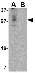 CDNF antibody