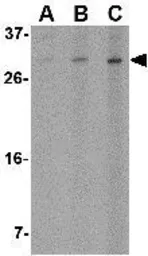 Anti-ORAI2 antibody used in Western Blot (WB). GTX85443