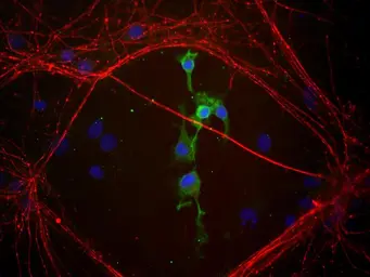Anti-Coronin 1A antibody used in Immunohistochemistry (IHC). GTX85452