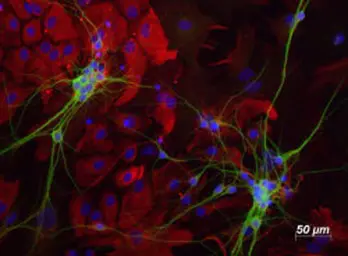 Anti-MAP2 antibody used in Immunohistochemistry (IHC). GTX85455
