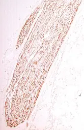 Anti-MPZ antibody used in IHC (Paraffin sections) (IHC-P). GTX85466