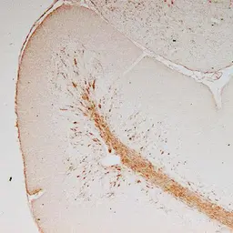 Anti-Vimentin antibody used in Immunohistochemistry (IHC). GTX85471