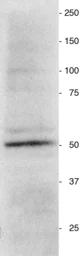 Anti-Vimentin antibody used in Western Blot (WB). GTX85471