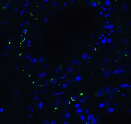 Anti-DDX58 antibody used in IHC (Paraffin sections) (IHC-P). GTX85488