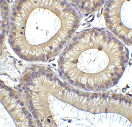 Anti-DDX58 antibody used in IHC (Paraffin sections) (IHC-P). GTX85488