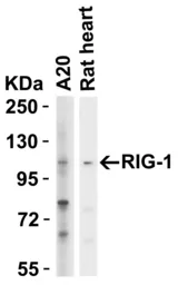 Anti-DDX58 antibody used in Western Blot (WB). GTX85488