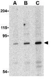 Anti-DDX58 antibody used in Western Blot (WB). GTX85488