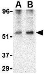 Anti-TIP47 antibody used in Western Blot (WB). GTX85491