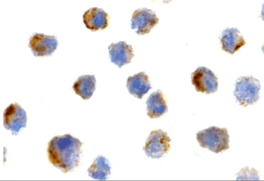 Anti-PTRH2 antibody used in Immunocytochemistry/ Immunofluorescence (ICC/IF). GTX85498