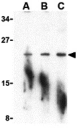 Anti-PTRH2 antibody used in Western Blot (WB). GTX85498