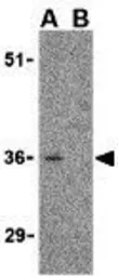 Anti-CTRP3 antibody used in Western Blot (WB). GTX85505