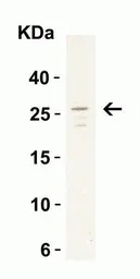 Anti-MD2 antibody used in Western Blot (WB). GTX85517