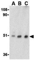 TTC5 antibody