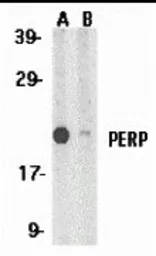 Anti-PERP antibody used in Western Blot (WB). GTX85520