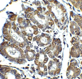 Anti-Noxa antibody used in IHC (Paraffin sections) (IHC-P). GTX85521
