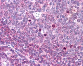 Anti-Aurora B (phospho Thr232) antibody used in IHC (Paraffin sections) (IHC-P). GTX85607