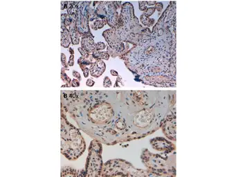Anti-Aurora B (phospho Thr232) antibody used in IHC (Paraffin sections) (IHC-P). GTX85607