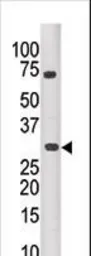 Anti-PIM3 antibody used in Western Blot (WB). GTX85641