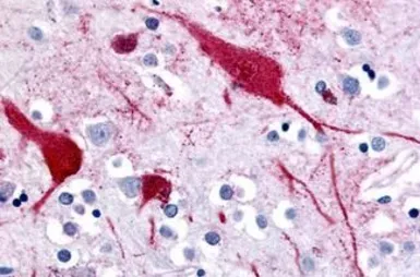 Anti-SLC5A9 antibody used in IHC (Paraffin sections) (IHC-P). GTX85650